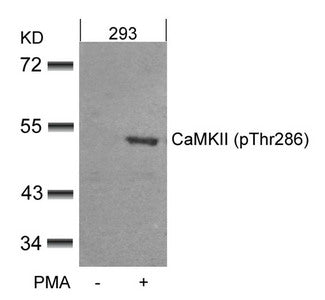 Phospho-CAMK2A (Thr286) Antibody