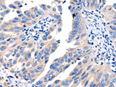 MSTN Antibody