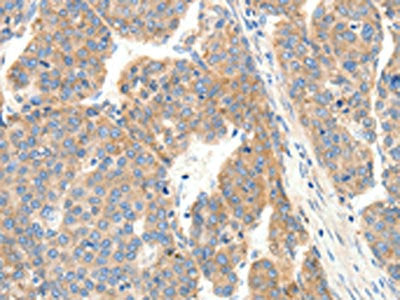 COL4A1 Antibody