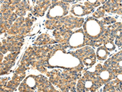 MMP9 Antibody
