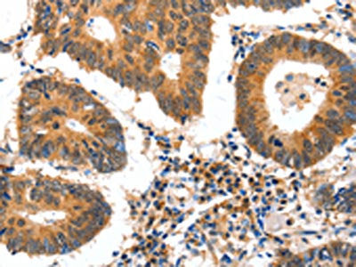 GDF6 Antibody