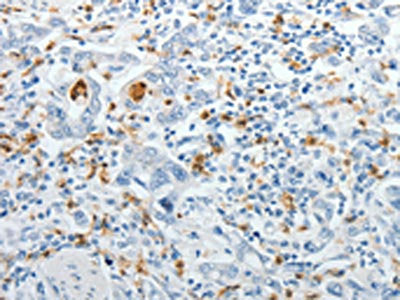 TOP1MT Antibody