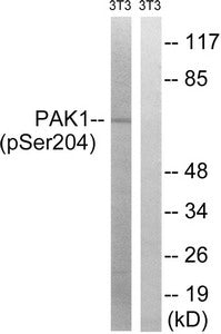 Phospho-PAK1 (Ser204) Antibody