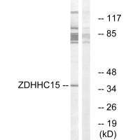 ZDHHC15 Antibody