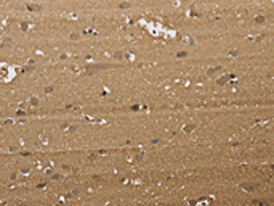 KDM5B Antibody