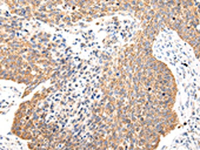 COL8A2 Antibody