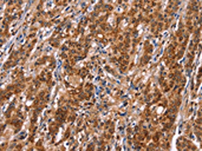 TDP2 Antibody