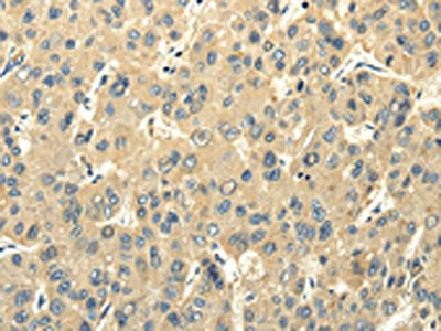 PMP2 Antibody