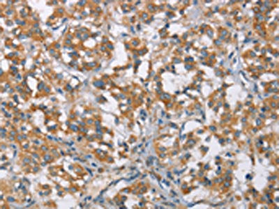 TLR6 Antibody