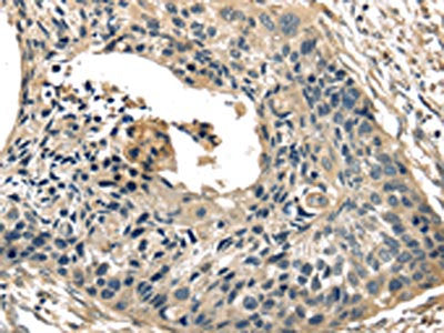 TXNIP Antibody