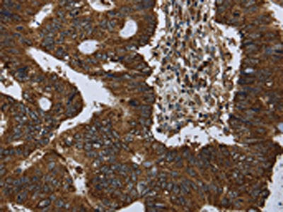 PPP1R13L Antibody