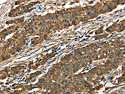 CTSE Antibody