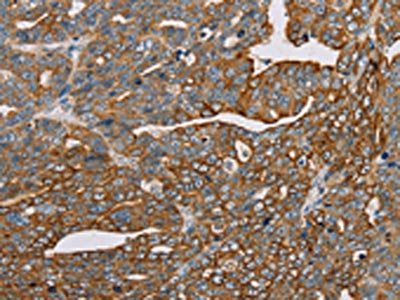 MTFP1 Antibody
