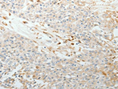 TNC Antibody