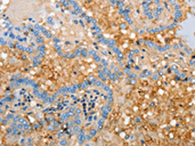 APOH Antibody