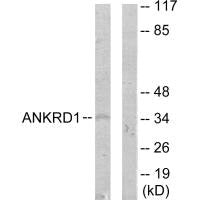 ANKRD1 Antibody