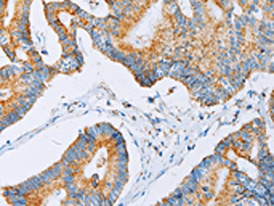 ACAA2 Antibody