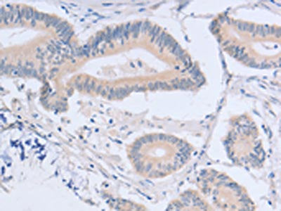 ACMSD Antibody