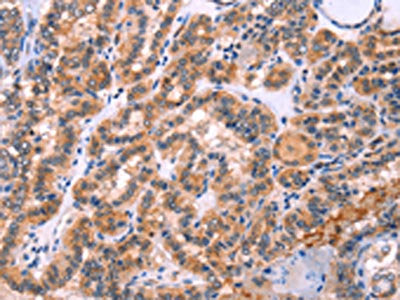 STXBP2 Antibody