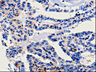CA3 Antibody