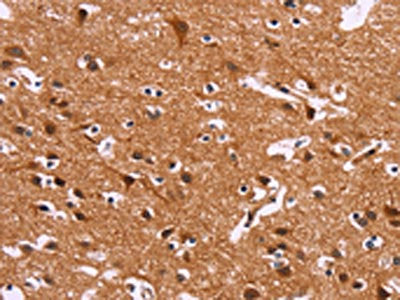 IRAK1BP1 Antibody