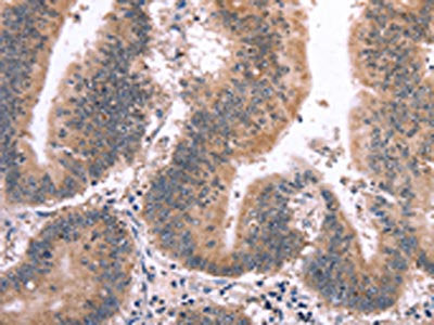 MAPK13 Antibody