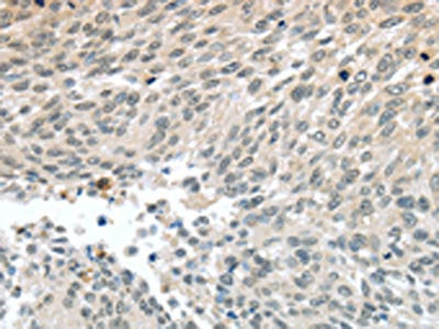 PALB2 Antibody