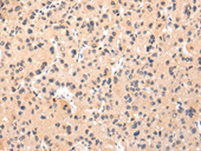IKZF4 Antibody