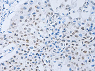 CSF1R Antibody