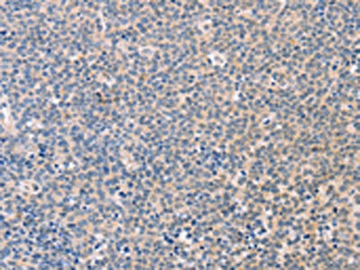 NCAM1 Antibody