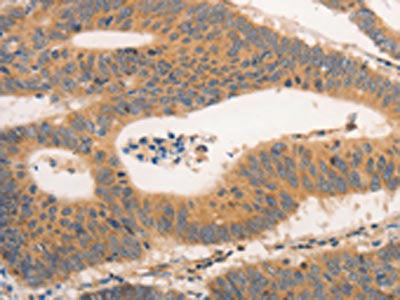 CSF3R Antibody