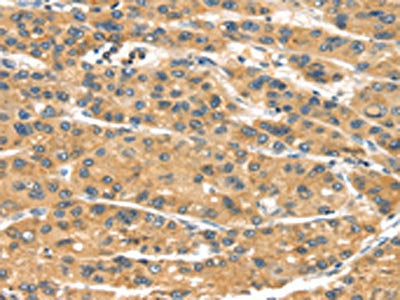 MACC1 Antibody