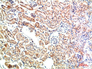 NFKBIA Antibody