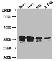 RCSF Antibody