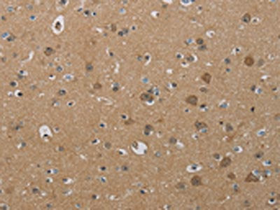 PHKG2 Antibody