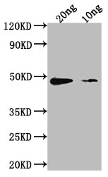 aur Antibody