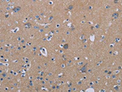 PDE4D Antibody
