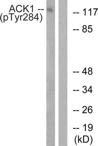 Phospho-TNK2 (Tyr284) Antibody