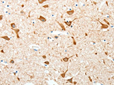 AKAP4 Antibody