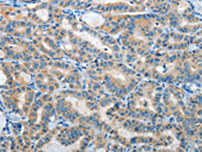 IL21R Antibody