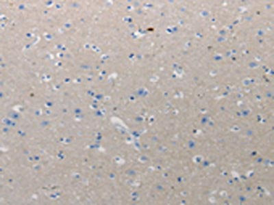 CMTM1 Antibody