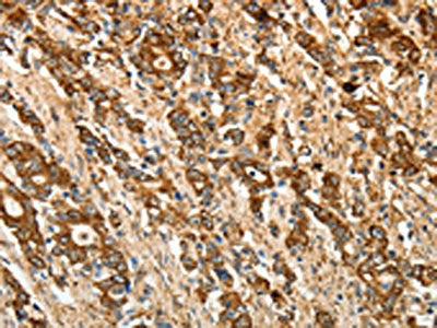 CALR Antibody