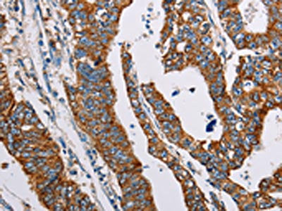 ALG2 Antibody