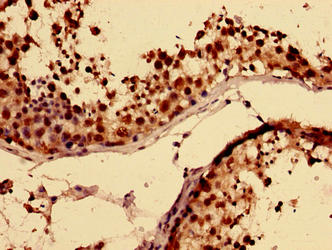 RBMY1A1 Antibody