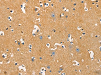 DNM3 Antibody