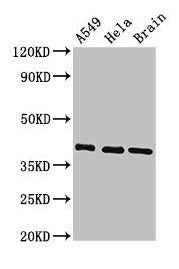 HLA-C Antibody