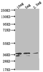Non-structural polyprotein Antibody