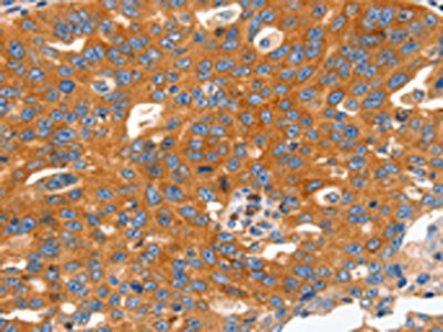CAP2 Antibody