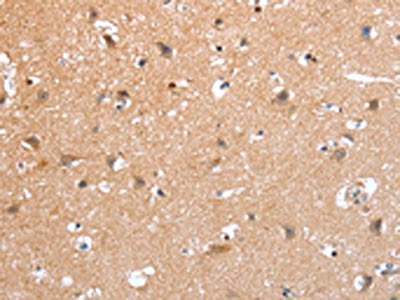 PSPN Antibody
