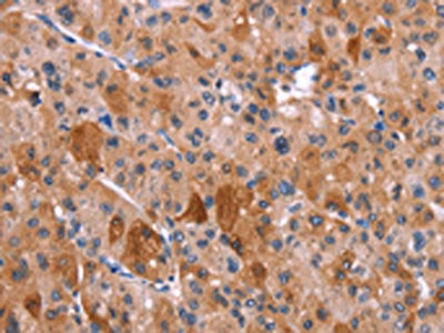 HRH1 Antibody